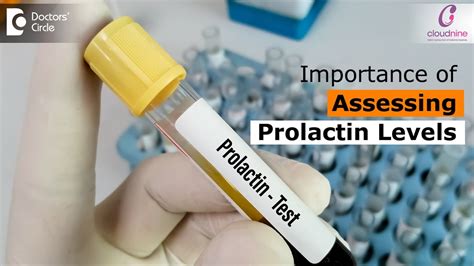 prolactin blood test bottle uk|high prolactin levels nhs.